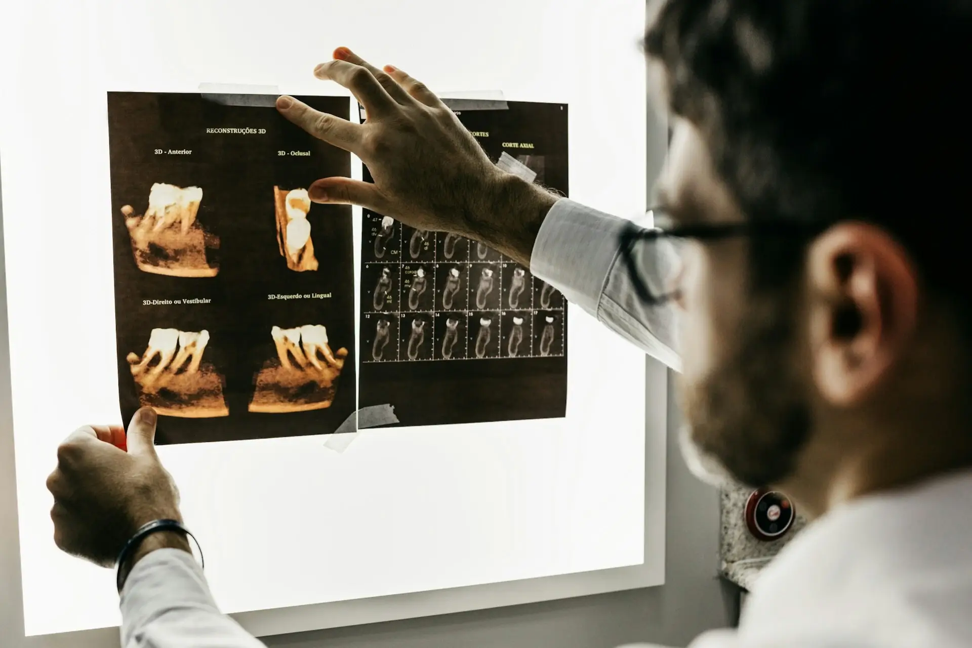 A male dentist looking x-rays of teeth against a white light on a wall